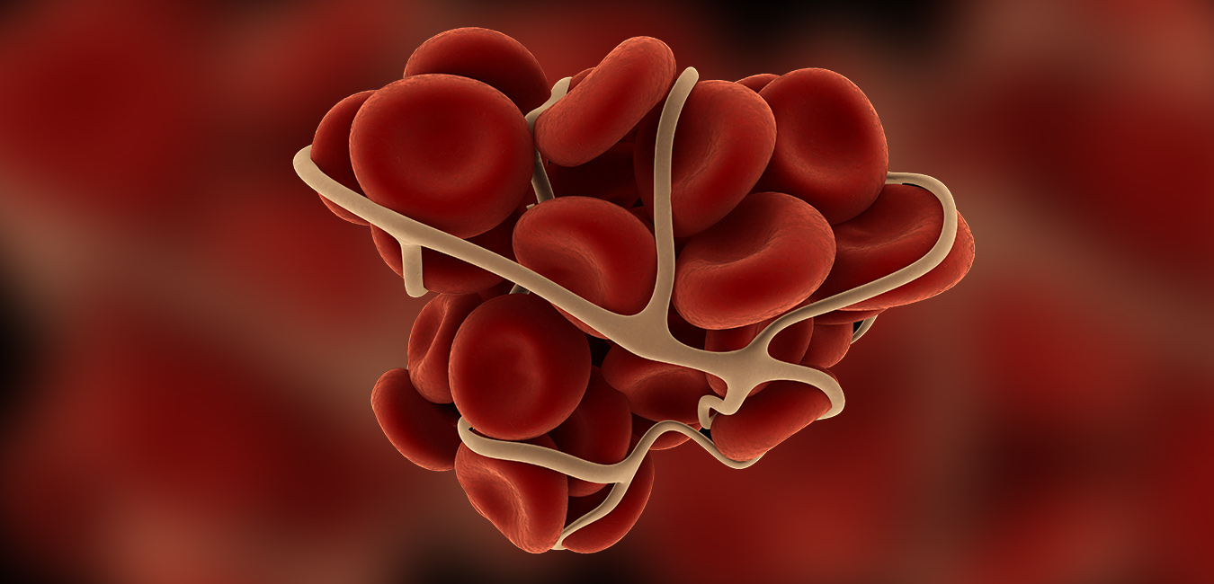 Choline, TMAO and Heart Health Cleveland HeartLab, Inc.